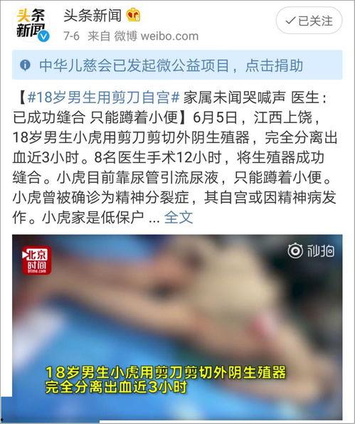 网红烫烟头爆料视频下载,揭秘烟头背后的惊人真相 第1张 网红烫烟头爆料视频下载,揭秘烟头背后的惊人真相 第1张